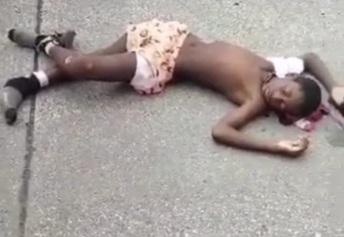 Minor run over by speeding car 