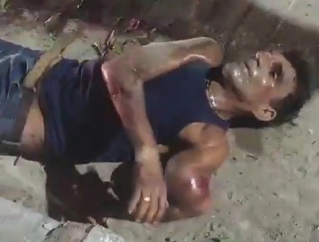 MAN IS SERIOUSLY INJURED AFTER BEING BEAT IN A BAR