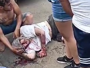 Couple on motorcycle crushed by speeding car 