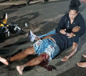 One dead and two injured motorcyclists after a horrific crash 