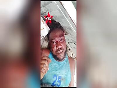 Haitian is murdered and burned by his rivals 