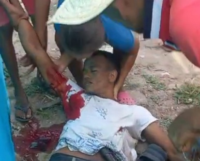 Colombia, man killed by sicario 