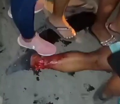 TERRIBLE MOTORCYCLE TRAFFIC ACCIDENT LEAVE TWO DEAD 