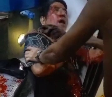 Shoot in the neck for resisting during armed robbery 