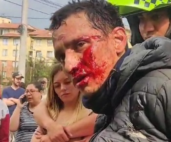 Thief arrested by police after a good beating 