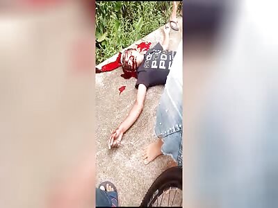 A young man was shot twice in the head