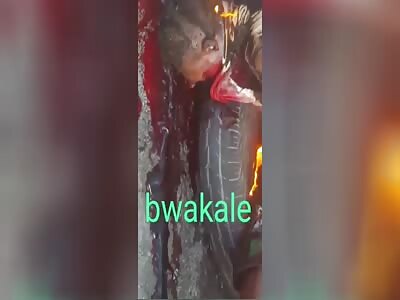 the man was burned on the tires