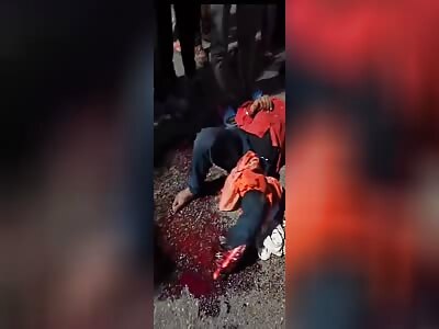 oh my god ,victims of horrible accident