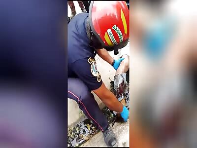 serious leg injuries 2