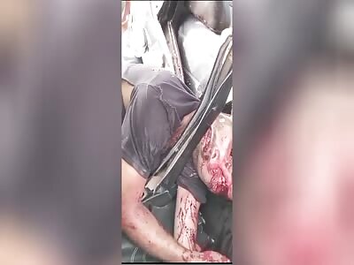 victim of a brutal accident