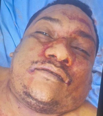 Sicario kill a man with six shots 