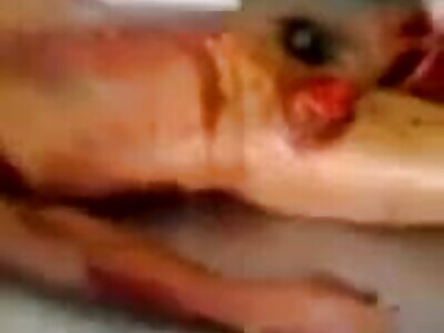 Brutally disfigured face