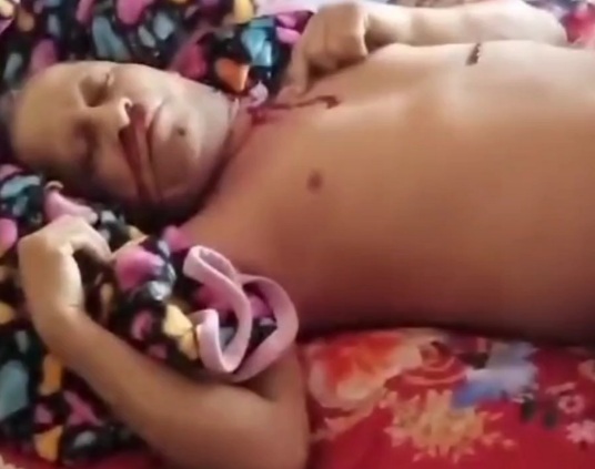 Sicario attack leave two dead 