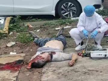 Chinese young man crashed skull by falling wall