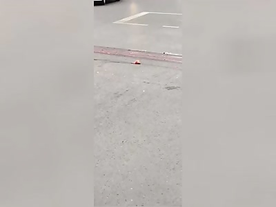 Woman's heart still beating after being removed from body by truck. 