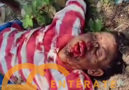 Sicario attack left a young man dead and 2 more injured