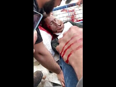 Arabs Throwing Snackbars at Settlers Gets Abu Killed