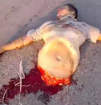 Horrific work accident leave worker split in half 