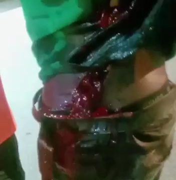 [ATTACK +AFTERMATH]BLACK AXE GANG MEMBERS MACHETE ATTACK 