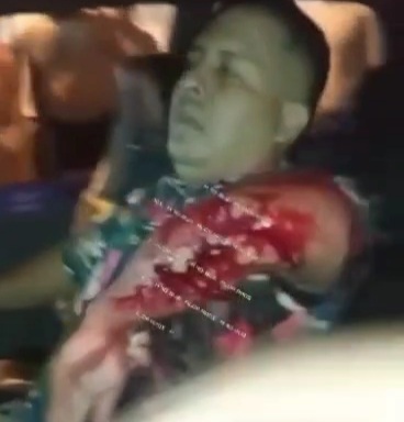 Driver wounded by bullet after armed robbery 