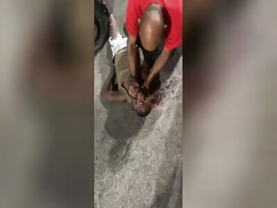 man seizure and after the accident