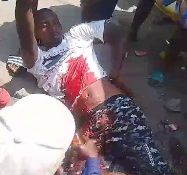 Drunk man gets shot after argument 