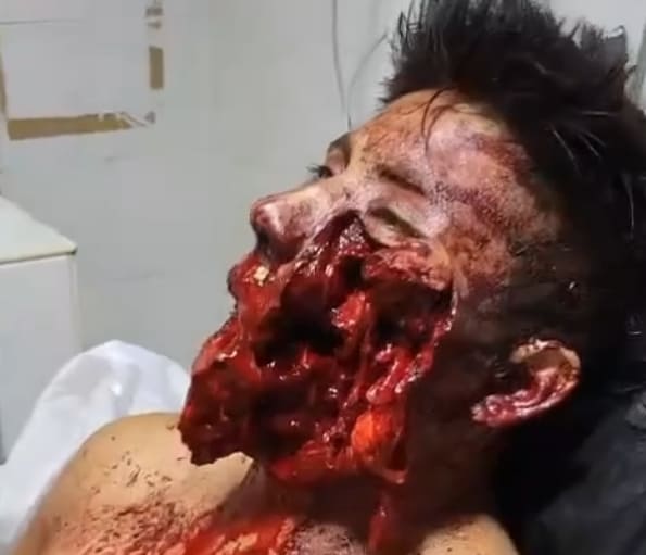 Probably Wishing He Wasn't Alive At This Moment