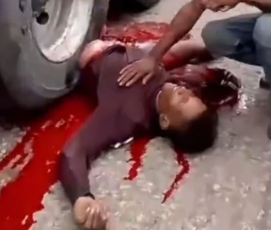 Living His Last Moments Under A Dump Truck