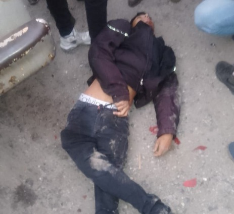 Motorcyclist crashed hard by speeding car 