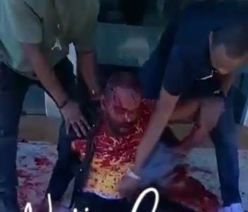 Vikings member stabbed by rival 