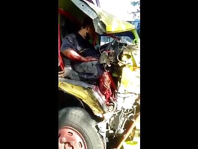 Truck driver lost leg in crash