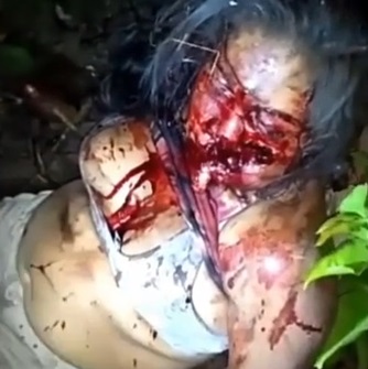 DISTURBING: Woman Victim of Vicious Machete Attack Defied Physics to Survive.