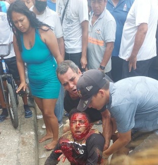 Local drug dealer shot by sicario 