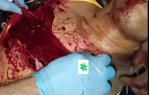 Young man stabbed to death by hitman 