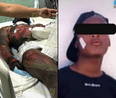 17 years old boy burned alive by farmers for stealing avocado 