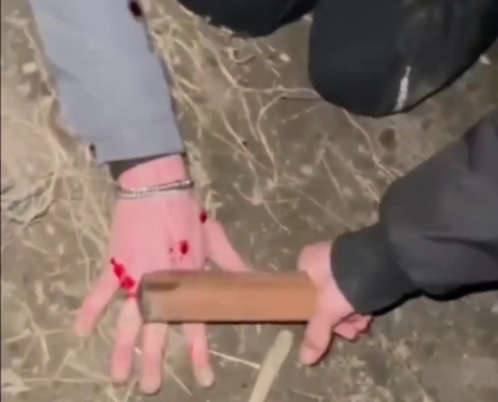 THE RUSSIAN DEBT COLLECTOR SMASHING SOME FINGERS 