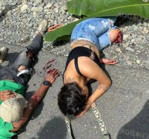 [Slide show]Couple horrifically injured due to motorcycle crash 