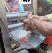 Hand Trapped in Sugarcane Mill