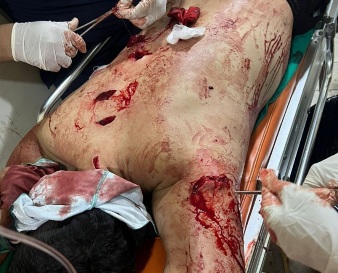 2 criminal arrested after ATTACKING with KNIVES and ALMOST KILLING 