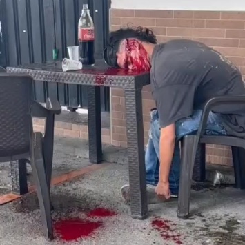 [THE LAST COCA-COLA] They surprised him with five shots to the head