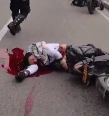 Motorcyclist cracked his skull after brutal crash 