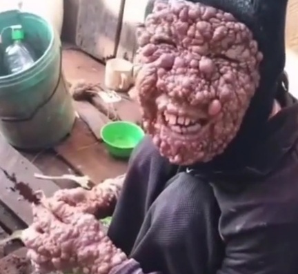 [GOD HELP US ALL] WHAT KIND OF DISEASE IS THIS!!!!!