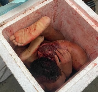 They Chopped Him In Pieces and Left on the Road Like a Trash