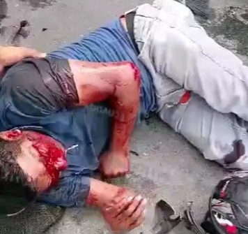 Motorcyclist crashed by drunk driver 