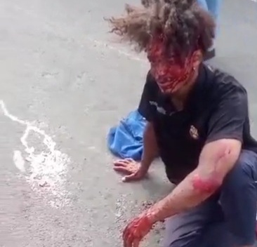 Motorcyclist survived a horrific crash 