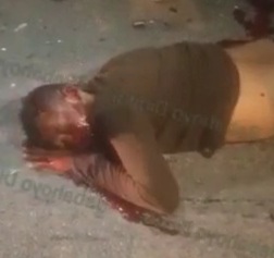 Horrific motorcycle accident leave man horrifically injured 