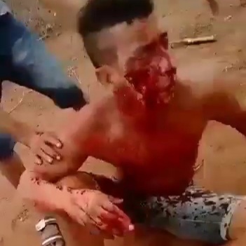 Man Gets a Shotgun to the Face 