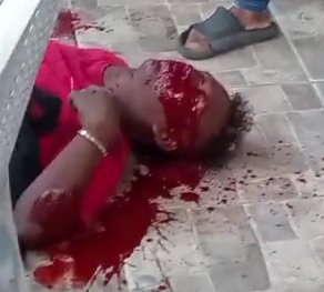 Local drug dealer gets fatally shot by sicario,ldied later in hospital