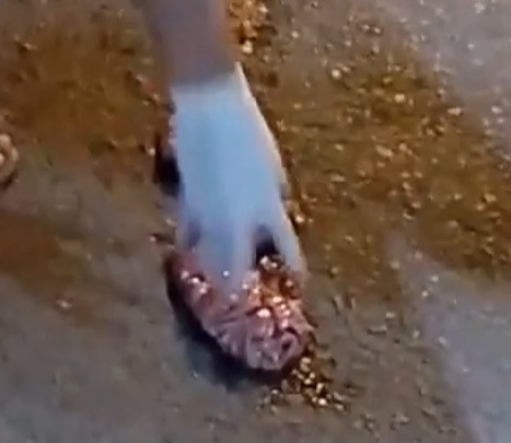 Brains Expelled After Motorcyclist's Head Was Crushed by Truck