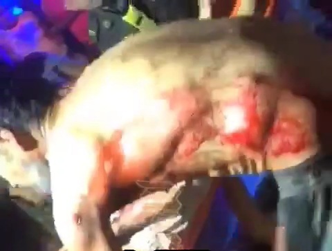 TWO WOMEN AND A MAN WERE WOUNDED BY BULLETS